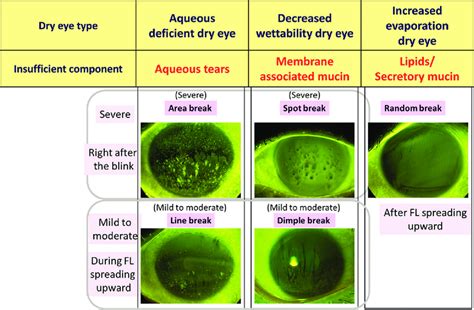 tear breakup time test dog|Investigation of fluorescein stain–based tear film breakup time test .